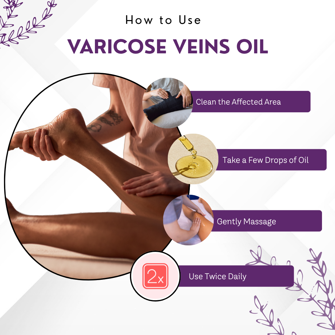 Varicose Veins Pain Relief Oil – 60 ml | Pain & Swelling Reduction