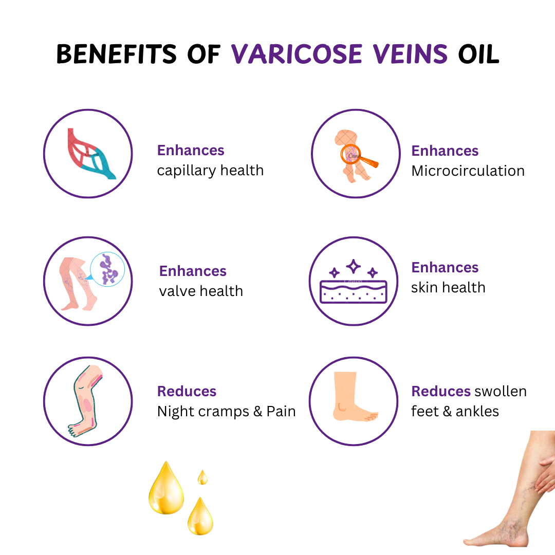 Varicose Veins Pain Relief Oil – 60 ml | Pain & Swelling Reduction